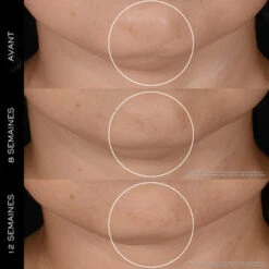 Lancome Coffret Rénergie Coffret Pour Femme 10 Lancome Coffret Rénergie Coffret Pour Femme -Kapao Magasin coffret genifique serum 4