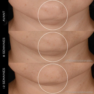 Lancome Coffret Rénergie Coffret Pour Femme 5 Lancome Coffret Rénergie Coffret Pour Femme – Image 5