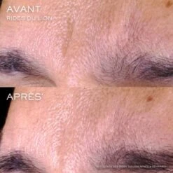 Lancome Rénergie C.R.x. Triple Sérum Rétinol Sérum Visage 26 Lancome Rénergie C.R.x. Triple Sérum Rétinol Sérum Visage -Kapao Magasin renergie crx tripl 12