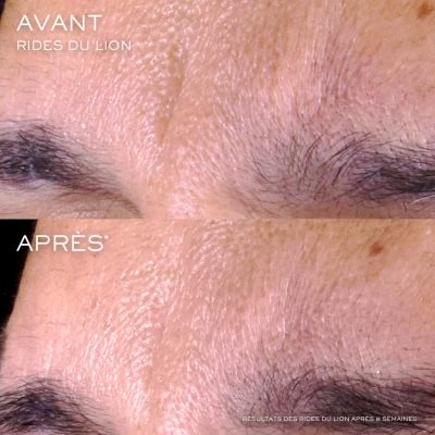 Lancome Rénergie C.R.x. Triple Sérum Rétinol Sérum Visage 6 Lancome Rénergie C.R.x. Triple Sérum Rétinol Sérum Visage – Image 6